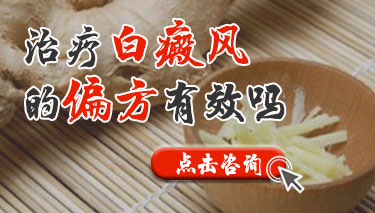 治疗白癜风有没有什么好的偏方呢?
