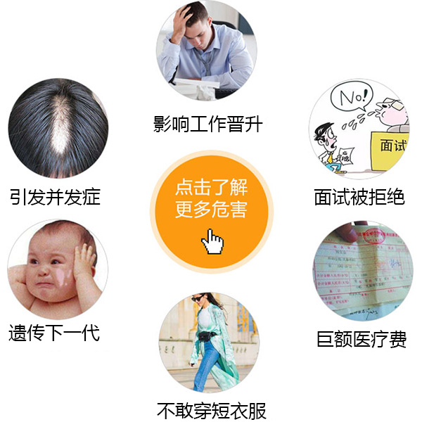 医生详解白癜风带给患者的危害