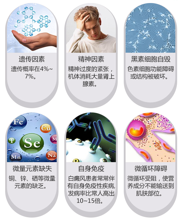 患上白癜风和哪些因素有关